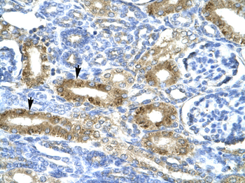 CHRND Rabbit Polyclonal Antibody