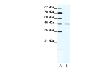 CHRND Rabbit Polyclonal Antibody