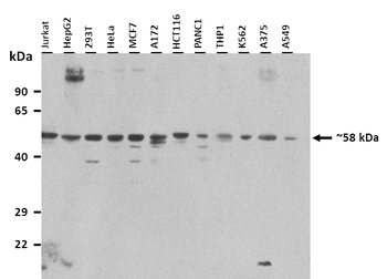 CHRNG Rabbit Polyclonal Antibody