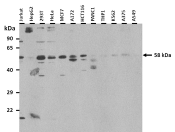 CHRNG Rabbit Polyclonal Antibody