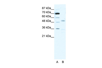 CHRNG Rabbit Polyclonal Antibody