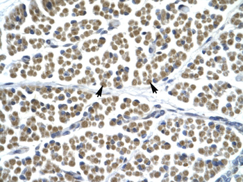 GABRD Rabbit Polyclonal Antibody