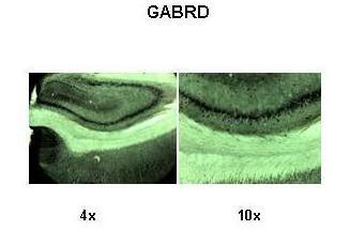 GABRD Rabbit Polyclonal Antibody