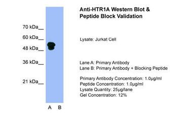 HTR1A Rabbit Polyclonal Antibody