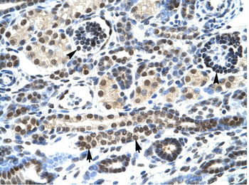 HTR3A Rabbit Polyclonal Antibody