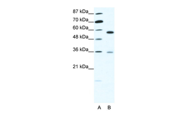 GDI1 Rabbit Polyclonal Antibody