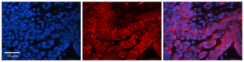 CTNNB1 Rabbit Polyclonal Antibody