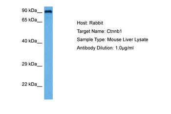 CTNNB1 Rabbit Polyclonal Antibody