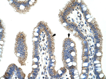 CTNNB1 Rabbit Polyclonal Antibody