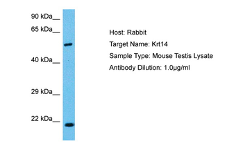 KRT14 Rabbit Polyclonal Antibody