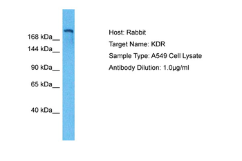 KDR Rabbit Polyclonal Antibody