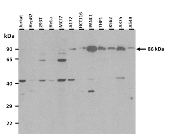 CTNNB1 Rabbit Polyclonal Antibody