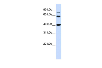 CTNNB1 Rabbit Polyclonal Antibody
