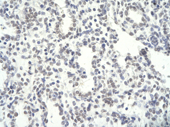 NFYC Rabbit Polyclonal Antibody