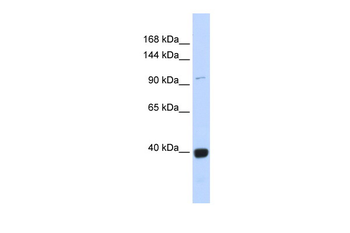 VAV1 Rabbit Polyclonal Antibody