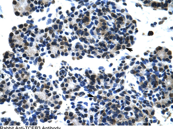 ELOA Rabbit Polyclonal Antibody