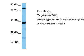 TCF12 Rabbit Polyclonal Antibody