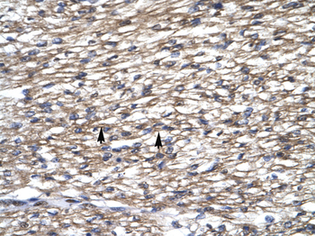 TAF1A Rabbit Polyclonal Antibody