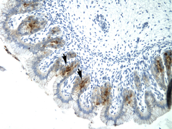 ETV6 Rabbit Polyclonal Antibody