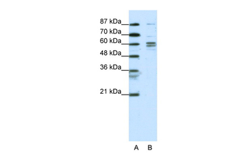 GTF2F1 Rabbit Polyclonal Antibody