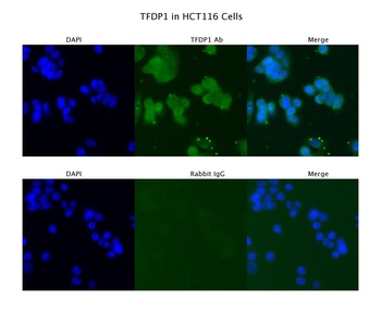TFDP1 Rabbit Polyclonal Antibody