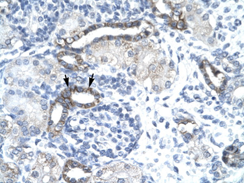 EVX1 Rabbit Polyclonal Antibody