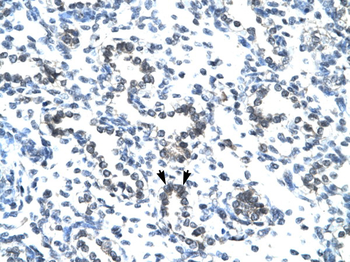 EVX1 Rabbit Polyclonal Antibody