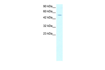 EVX1 Rabbit Polyclonal Antibody