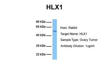 HLX1 Rabbit Polyclonal Antibody
