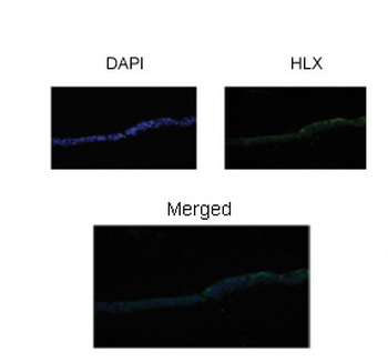 HLX1 Rabbit Polyclonal Antibody