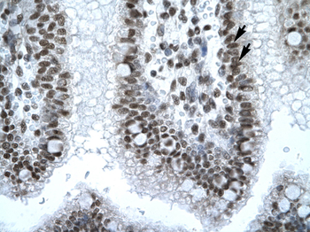 IRF8 Rabbit Polyclonal Antibody