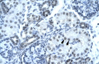 PAX2 Rabbit Polyclonal Antibody