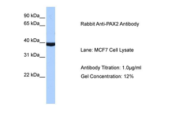 PAX2 Rabbit Polyclonal Antibody