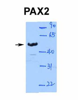PAX2 Rabbit Polyclonal Antibody