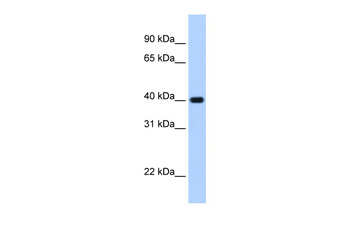 ZNF187 Rabbit Polyclonal Antibody
