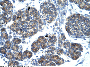 SNAPC1 Rabbit Polyclonal Antibody