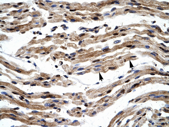 GTF2E1 Rabbit Polyclonal Antibody