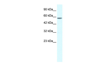 GTF2E1 Rabbit Polyclonal Antibody