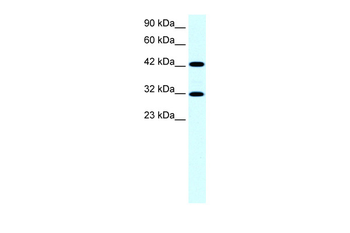 GTF2H2 Rabbit Polyclonal Antibody