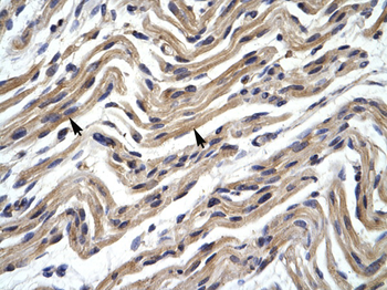 YY1 Rabbit Polyclonal Antibody