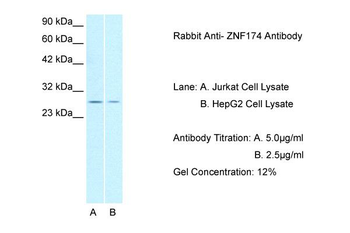 ZNF174 Rabbit Polyclonal Antibody