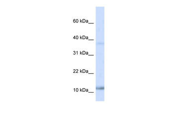 NHLH1 Rabbit Polyclonal Antibody