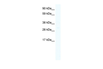 HOXC6 Rabbit Polyclonal Antibody