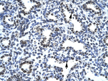 PC4 Rabbit Polyclonal Antibody