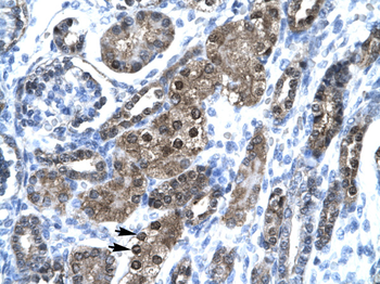 SNAPC2 Rabbit Polyclonal Antibody