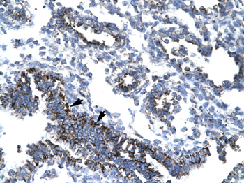 TAF7 Rabbit Polyclonal Antibody