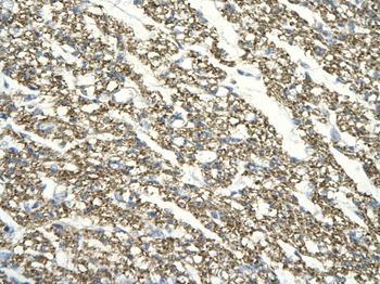 TAF7 Rabbit Polyclonal Antibody