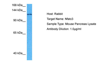 NFATC3 Rabbit Polyclonal Antibody