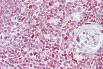 NFATC3 Rabbit Polyclonal Antibody