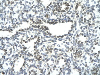 NFATC3 Rabbit Polyclonal Antibody